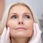 Thread Lifts vs. Hyaluronic Acid: Choose the Best Non-Surgical Face-Lift Method